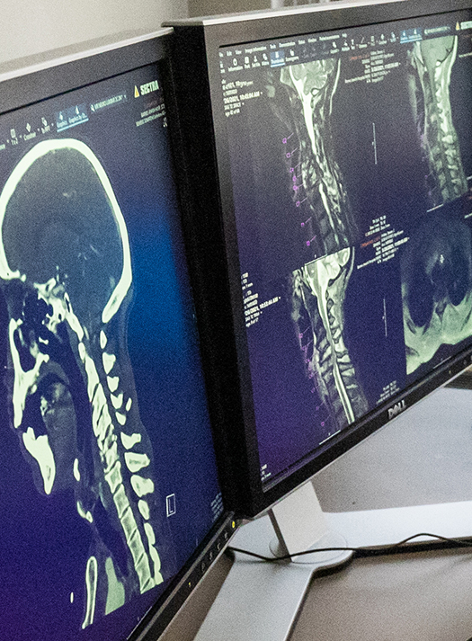 Two computer screens show x-rays of a patient's skull and spine which are examined by neuroradiologists at Mallinckrodt Institute of Radiology.