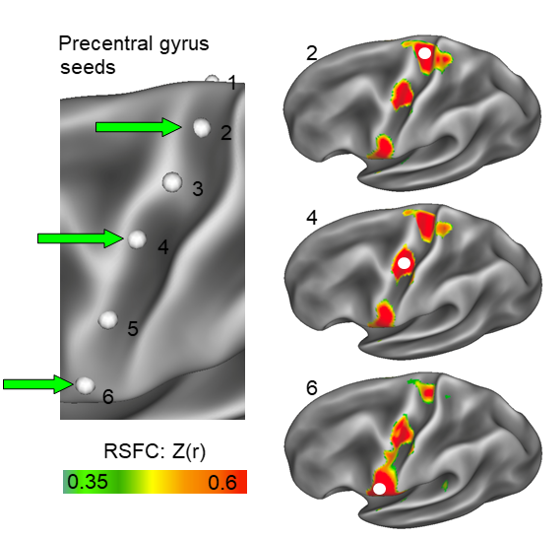 The Gordon Precision Neuroimaging Lab identified a new somato-cognitive action network within primary motor cortex. It consists of three interconnected patches interspersed between the known effector-specific regions for control of the feet, hands, and face.