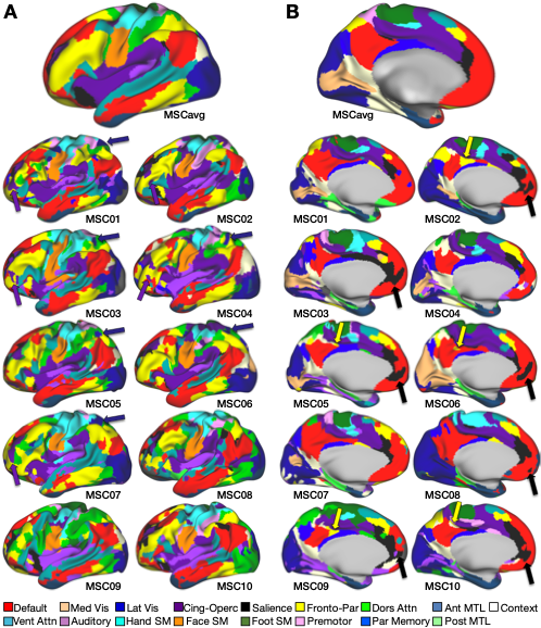 We developed approaches for precisely mapping brain networks within individual humans by collecting large quantities of data within each person. This revealed features of brain networks present within many individuals (arrows) that do not appear in group average network maps (top).