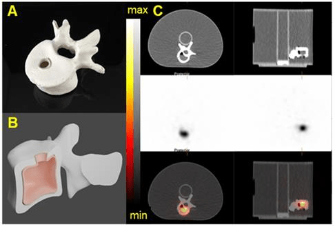 Imaging an anthropomorphic vertebral phantom filled with 40 kBq/mL Radium-223 on the GE Discovery 670.