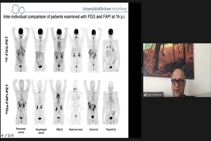 Dr. Uwe Haberkorn presented virtually “Design and Problems of Tumor Targeting Tracers”