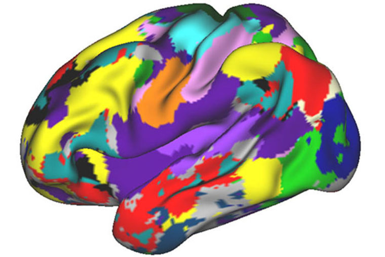 A colorful brain scan of Associate Professor of Neurology and Radiology Nico Dosenbach, MD, PhD.
