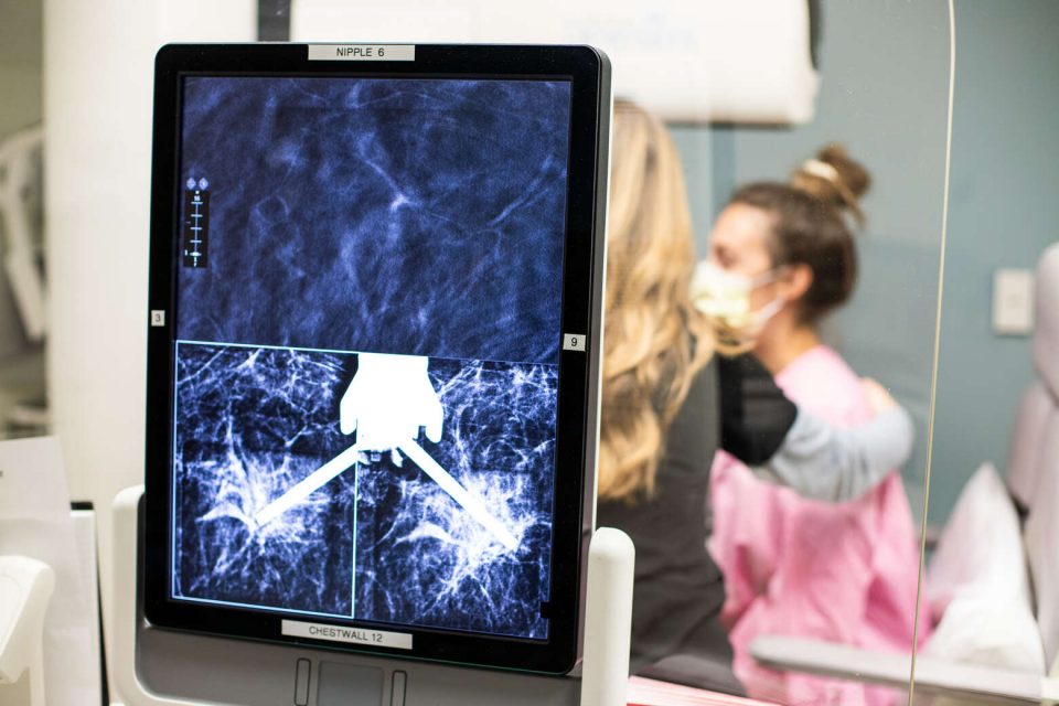 Breast Imaging Mallinckrodt Institute of Radiology Washington