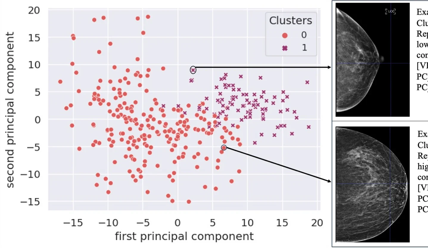 Scatter plot displaying the identified breast parenchymal complexity clusters along with one example of mammographic images from each cluster.