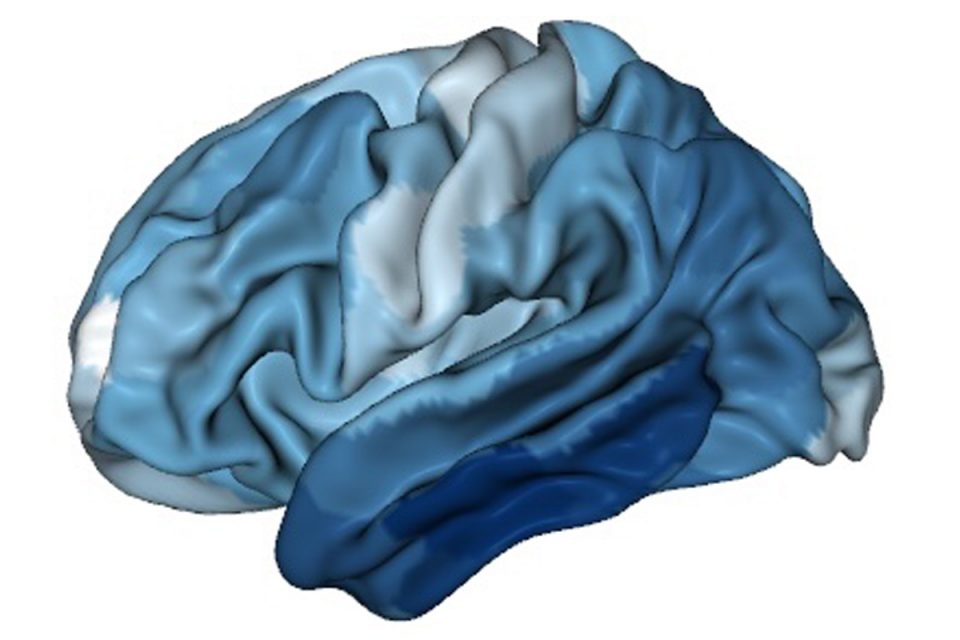 Mir Researchers Awarded 5 Million To Study Early Brain Development