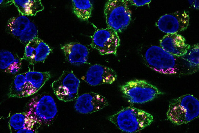 WashU Medicine researchers show in mice that their technique to designing medications, in which modular components of anti-cancer drugs are administered separately and assembled in the body using what's known as click chemistry, is more effective than standard treatments at targeting and shrinking tumors. Shown is a drug they designed, labeled in pink and green, bound to pancreatic cancer cells from mice.