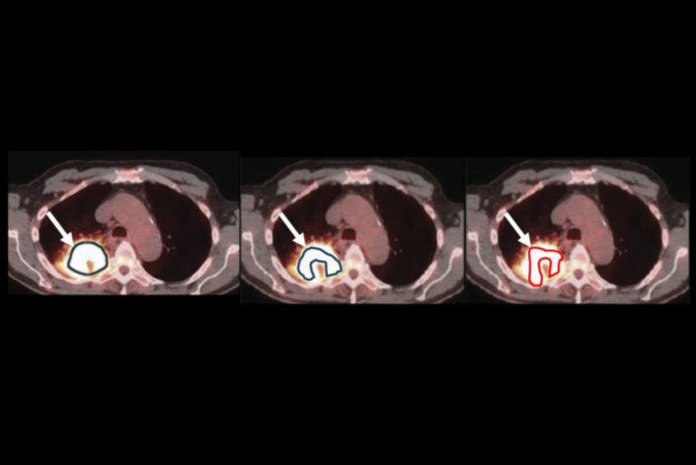 WashU Researchers Develop Technique to Assess Reliability of Medical AI