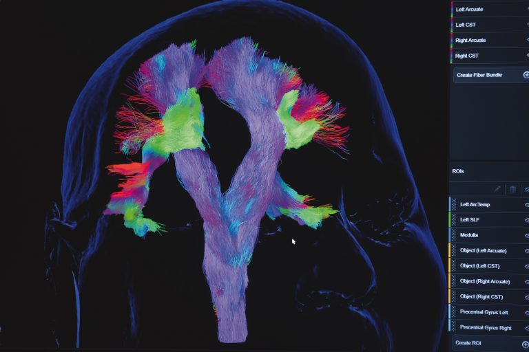The Imaging Engine Behind an FDA-Cleared Brain-Mapping Tool